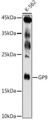 Western Blot: GP-IX AntibodyAzide and BSA Free [NBP3-03507]